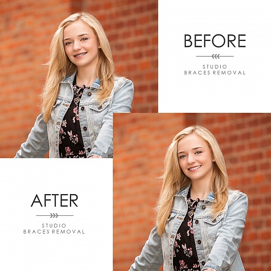 BEFORE & AFTER - POST-PRODUCTION
